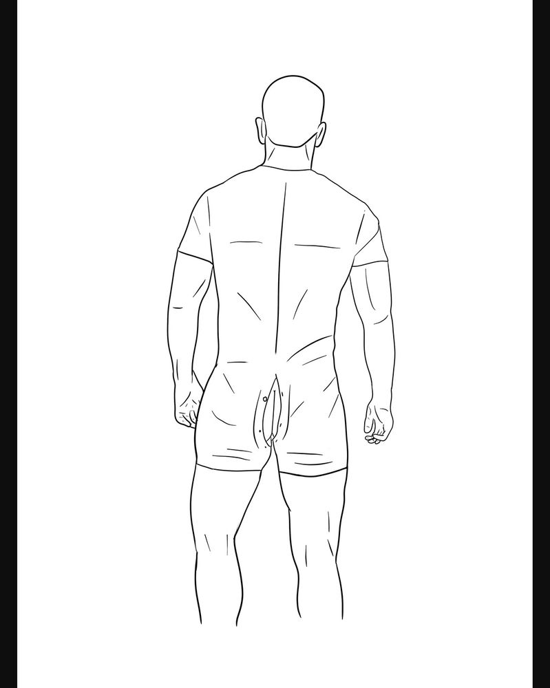 Pattern reference P-078
